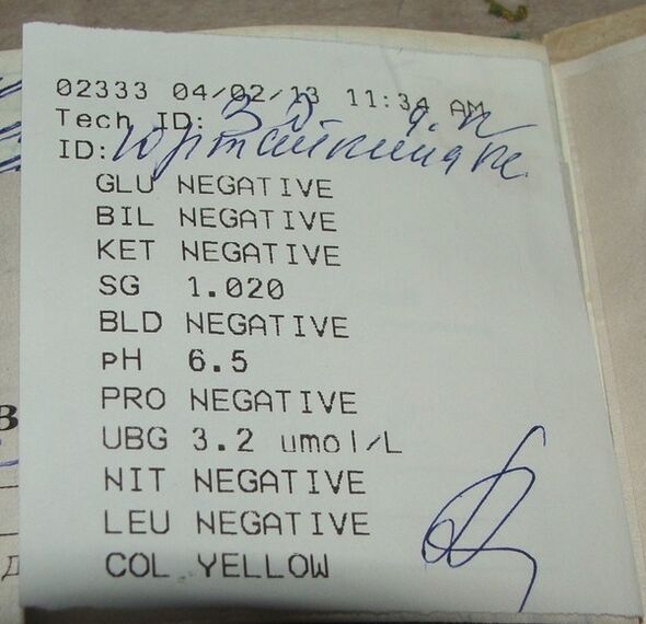 Meus resultados de análise de urina antes do femixal